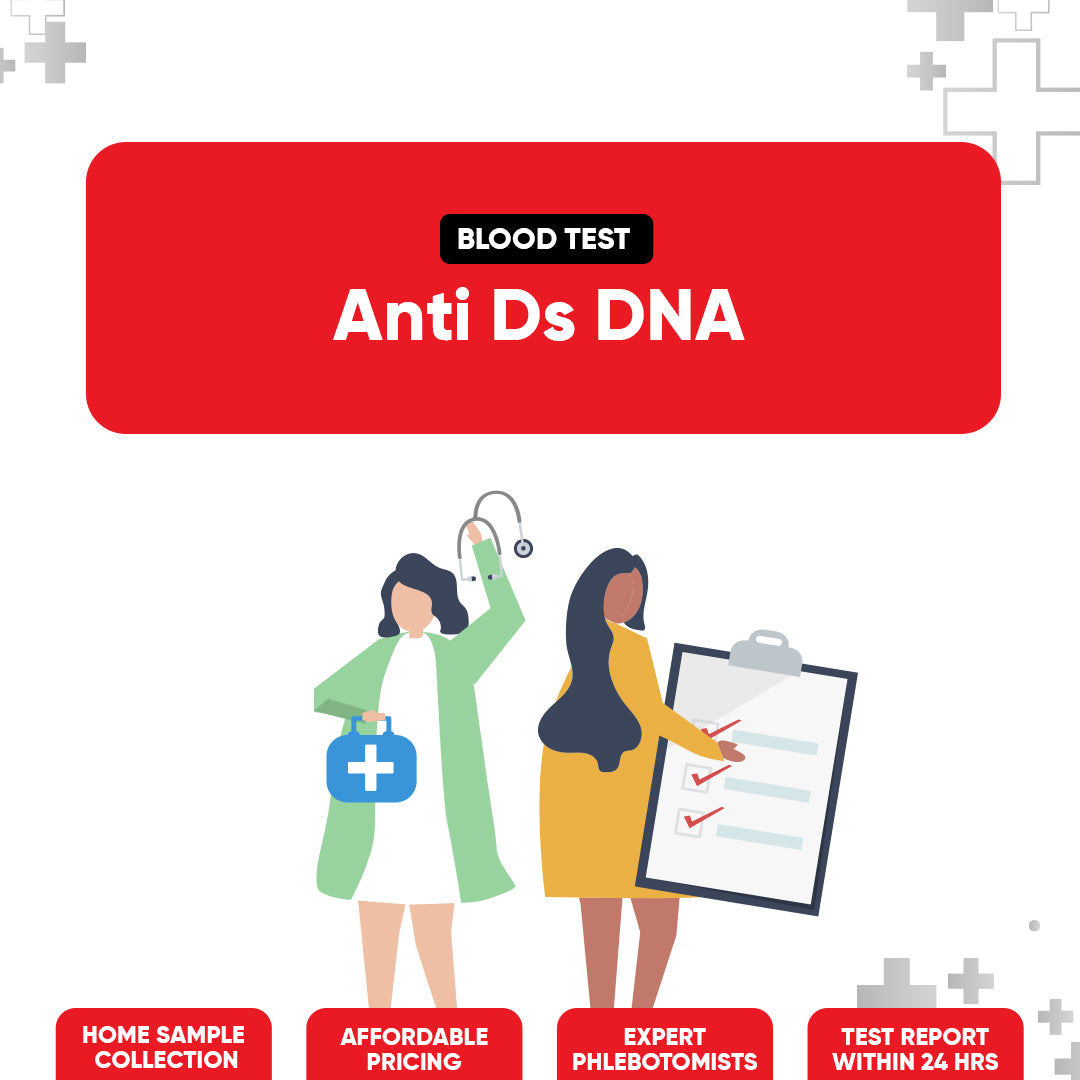 Anti Ds DNA Test