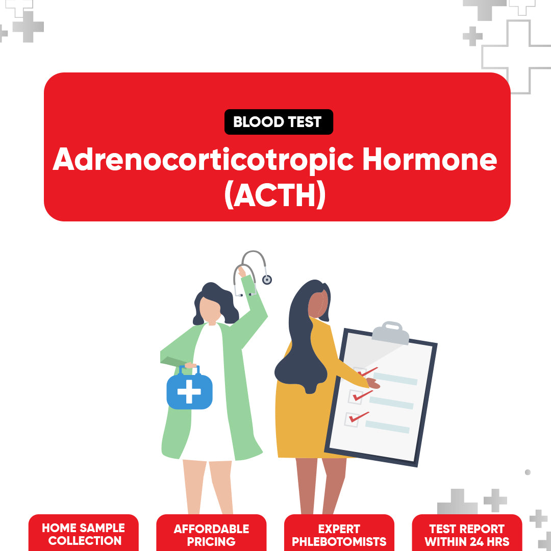 Adrenocorticotropic Hormone (ACTH) Test