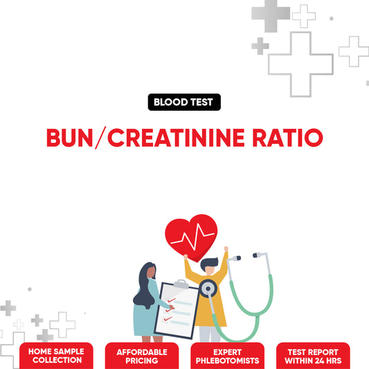 BUN / Creatinine Ratio Test