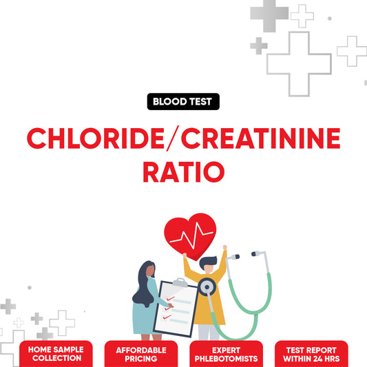 Chloride/Creatinine Ratio Test