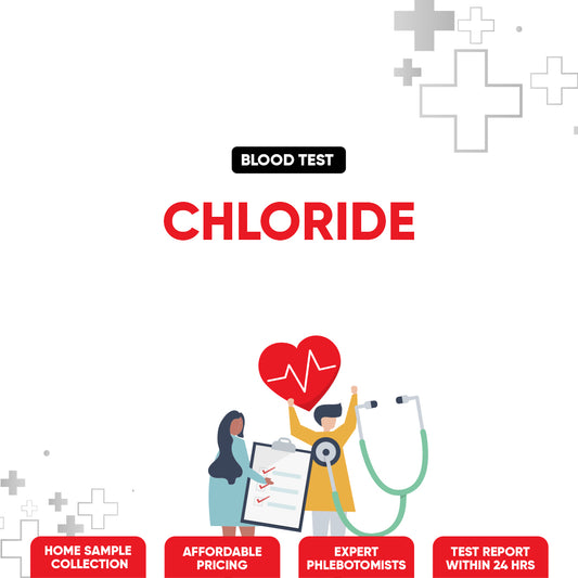 Chloride Test
